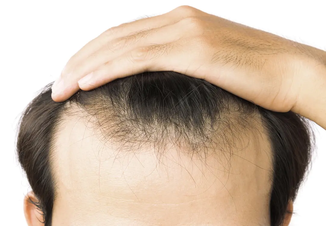 Hair Transplant Clinic